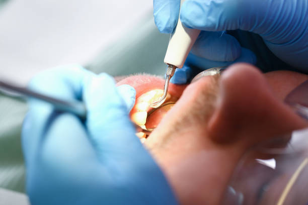 Best Cracked Tooth Emergency Dentist  in Belle Chasse, LA