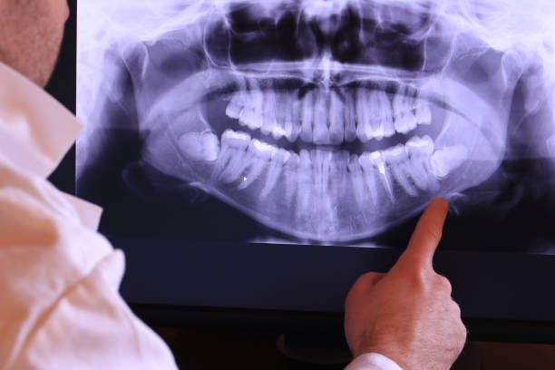 Best Tooth Infection Emergency Dentist  in Belle Chasse, LA